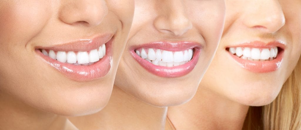 Zahnschienen und ästhetische Zahnheilkunde: Eine perfekte Kombination