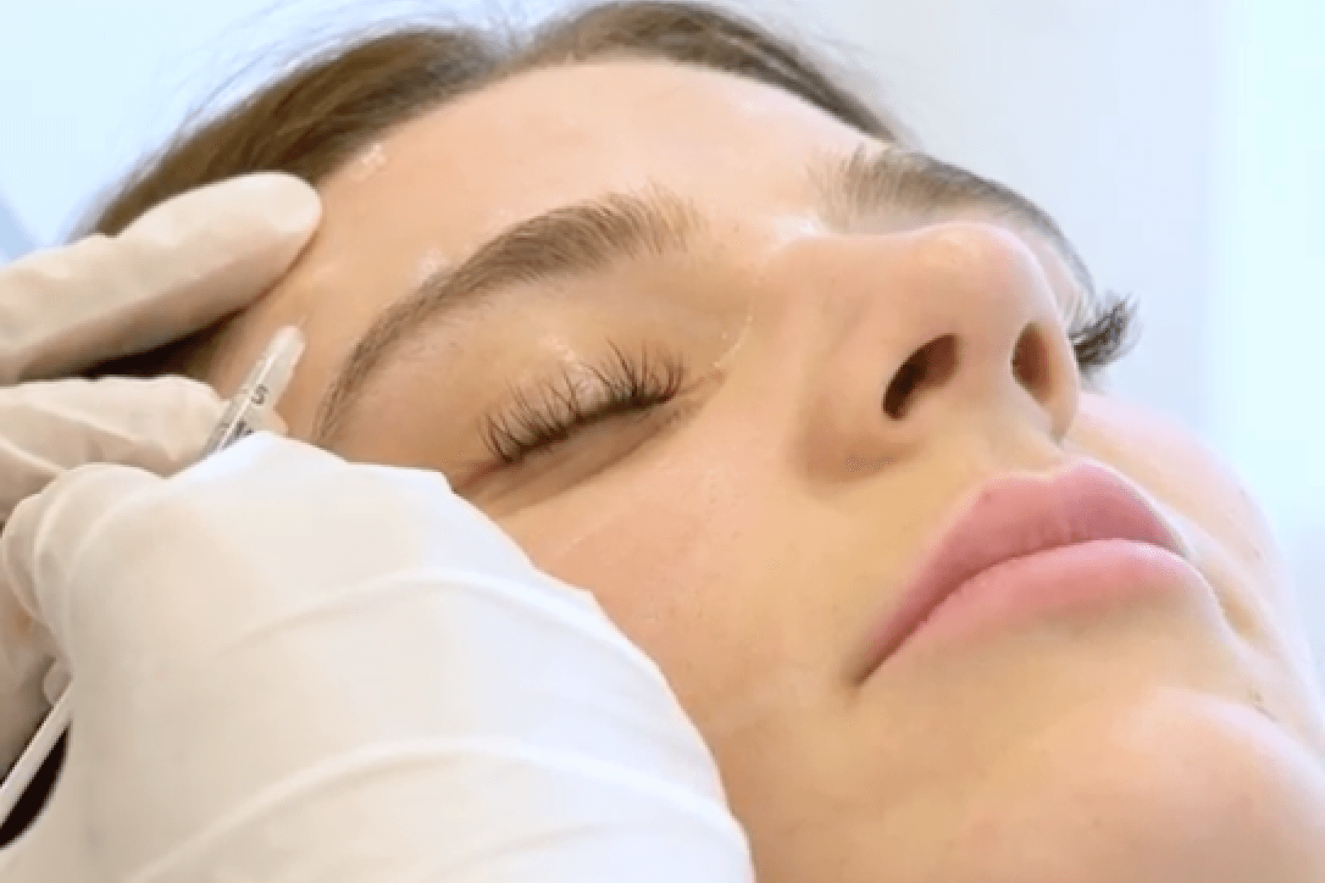 Hyaluron Nürnberg bei MY AESTHETICS: Perfekte Lippenunterspritzung für Ihre Schönheit