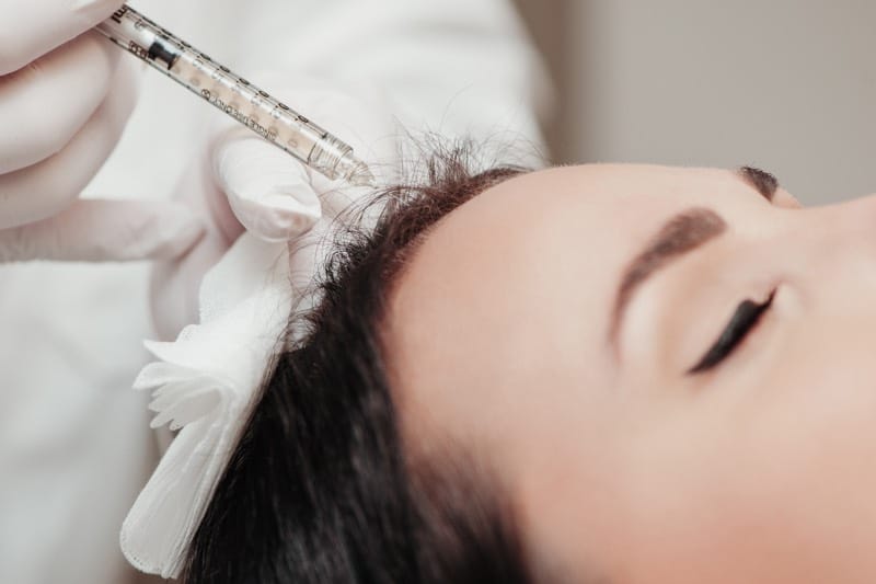 PRP Behandlung Berlin: Die perfekte Lösung für Hautverjüngung und Haarausfall bei Dr. Jeannette Jungk