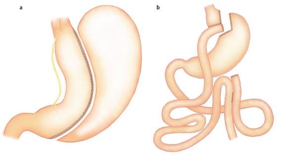 Magen Op Türkei: Qualität, Sicherheit und faire Preise